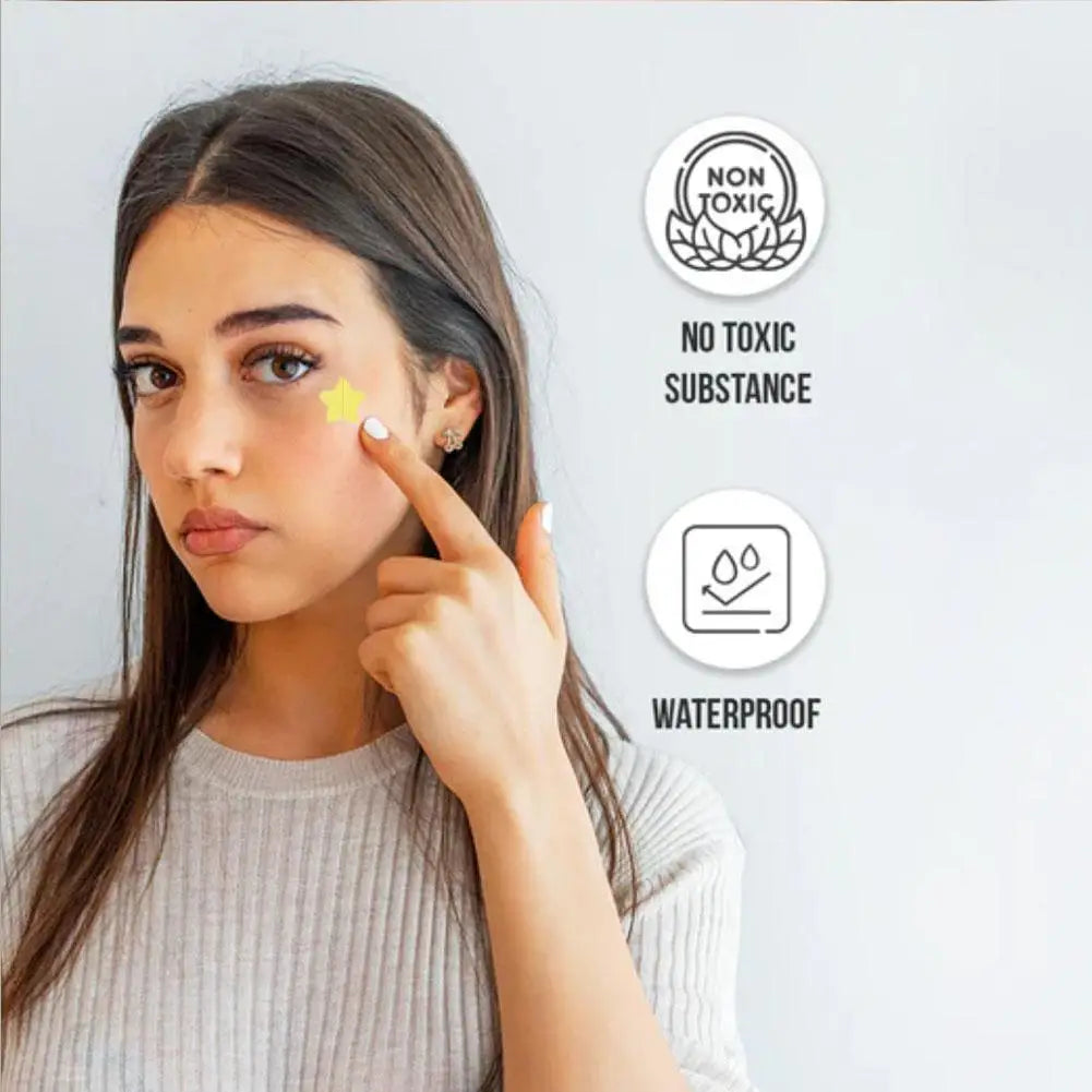 Cutie Clear Star Pimple Patch Set – 360pcs