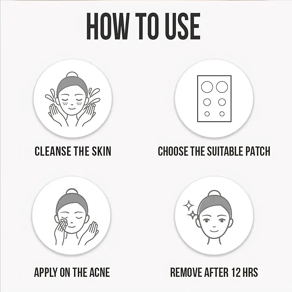 Cutie Clear Star Pimple Patch Set – 360pcs